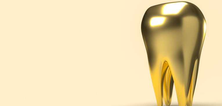 Wie hoch ist der aktuelle Goldpreis pro Gramm Zahngold?