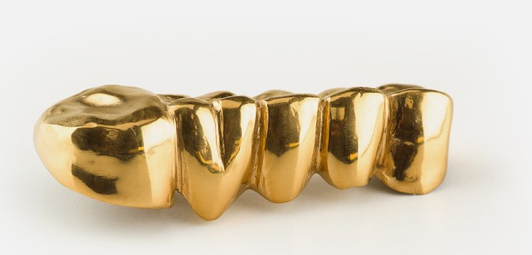 Was ist Bruchgold?