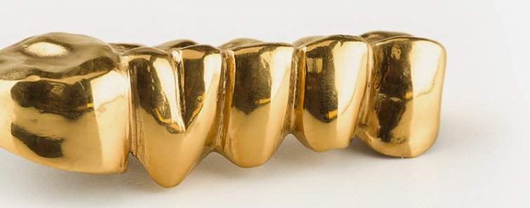 Zahngold Ankauf