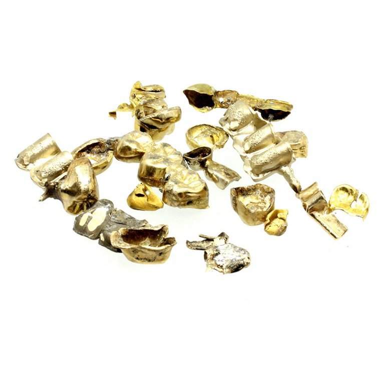 Zahngold in Dorsten verkaufen