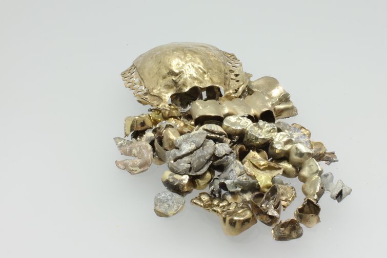 Zahngold in Gummersbach verkaufen