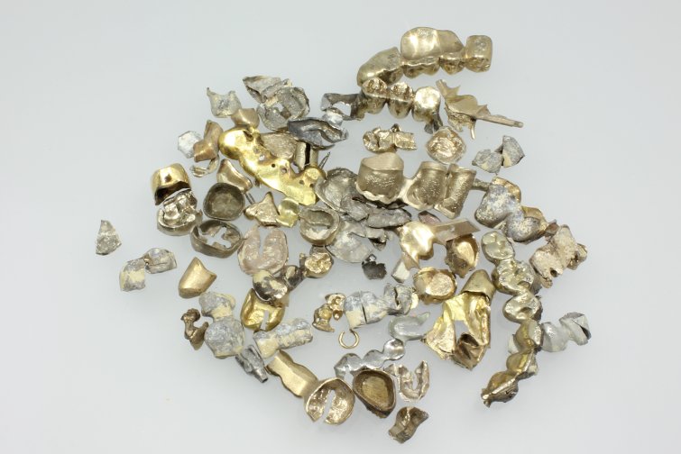 Zahngold in Köln Rodenkirchen verkaufen