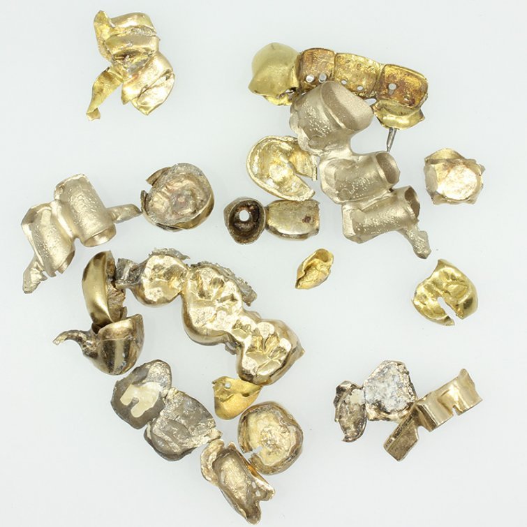 Zahngold in Kürten verkaufen