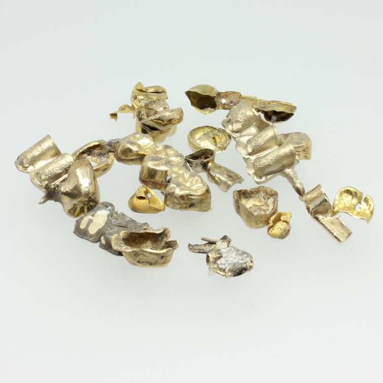 Zahngold in Mülheim an der Ruhr verkaufen
