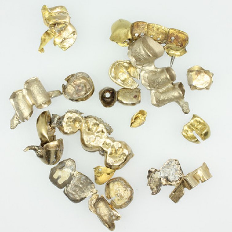 Zahngold in Troisdorf verkaufen