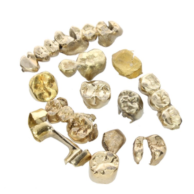 Zahngold in Witten verkaufen