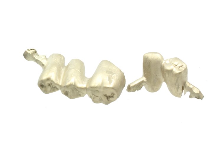 Zahngold verkaufen in Mannheim